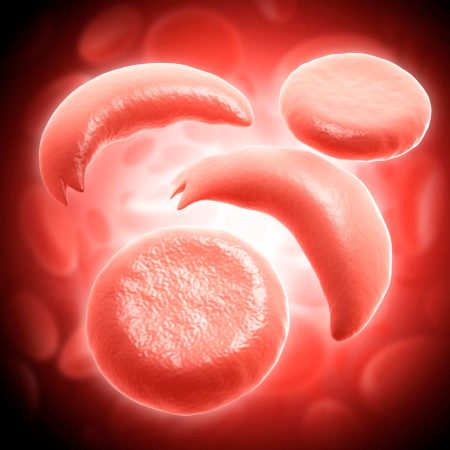 How mRNA Could Cure Sickle Cell Gene Mutations